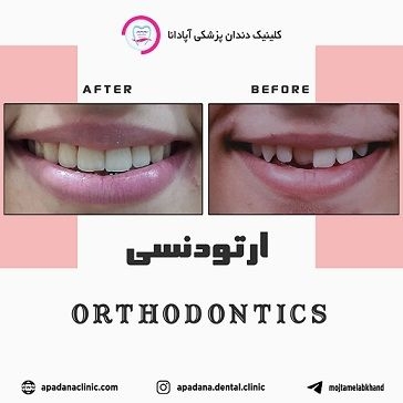 Orthodontics